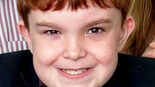 Implante pionero salva a niño de 11 años