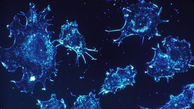 Descubrieron qué elemento puede ayudar a prevenir y combatir el cáncer