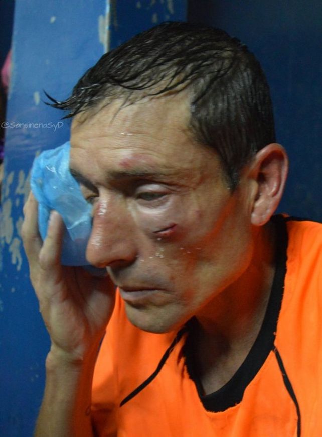 Peligra el Superclásico: Los árbitros irían al paro general por la agresión a Elichiri
