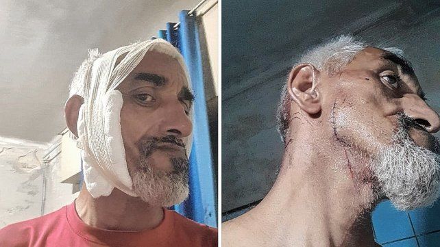 Apuñalaron en la cara a un repartidor para robarle la bici en el centro santafesino Apuñalaron en la cara a un repartidor para robarle la bici en el centro santafesino