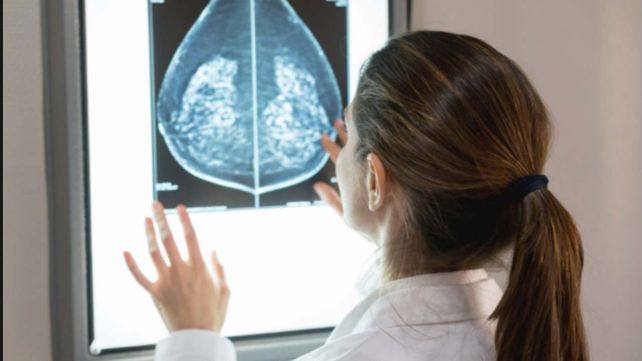 El equipo que lideró el trabajo pertenece al International Breast Cancer Center (IBCC) de Barcelona.