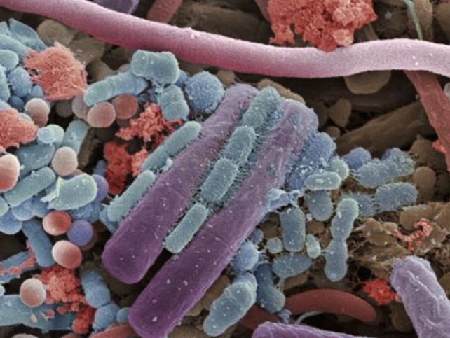 Esto es lo que hay en tu boca. Nuestros microbios siempre están en su propio sitio. Esta imagen es de la microbiota oral