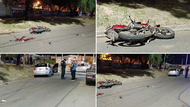Un motociclista resultó con fractura grave al colisionar de frente contra un auto en la zona este de Paraná