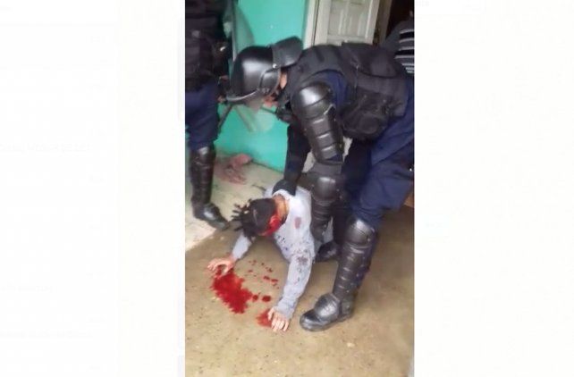 Perdió el ojo tras recibir el impacto de una bala de goma de la policía