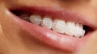 La exposición en fotos y redes aumentó los pedidos de tratamientos odontológicos.