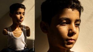 Un niño palestino mutilado por los bombardeos de Israel sobre Gaza