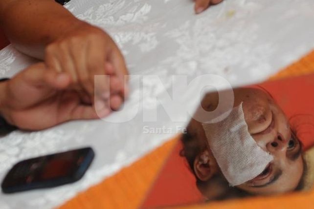 Hablaron las víctimas de las dos bombas en barrio Liceo Norte