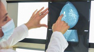Cáncer de mama. Señales de alerta y controles de prevención en el Día Mundial del Cáncer de Mama.