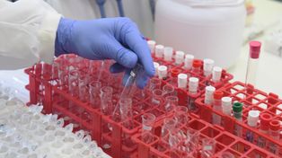 Mucha gente quiere saber si se contagió, sobre todo porque teme un segundo contagio, se indicó en los laboratorios.