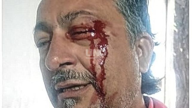 Chofer de las aplicaciones de viajes Uber y Didi denunció una brutal agresión por parte de remiseros: Callate la boca