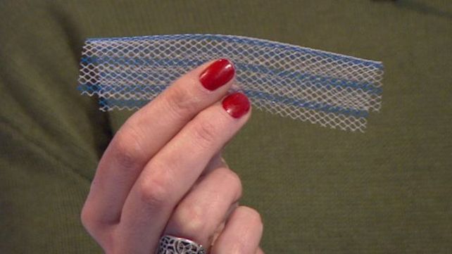 Los implantes de mallas vaginales por los que cientos de mujeres están en pleito en Reino Unido