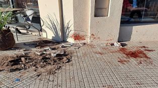 Bestial: un muchacho sufrió una doble fractura de maxilar luego de ser golpeado entre cuatro personas
