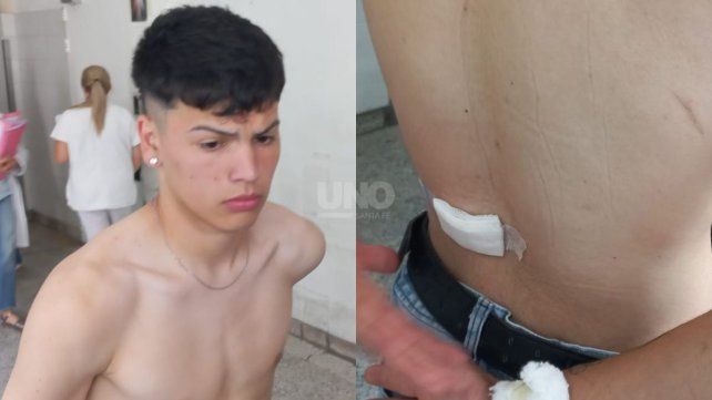 Axel se encontraba junto a un grupo de amigos en la zona de la Costanera cuando fue impactado por un balazo