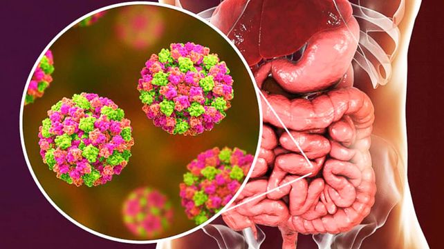 El diagnóstico de Norovirus fue confirmado por el Instituto Malbrán luego se que se detectaran casi 200 casos. Síntomas