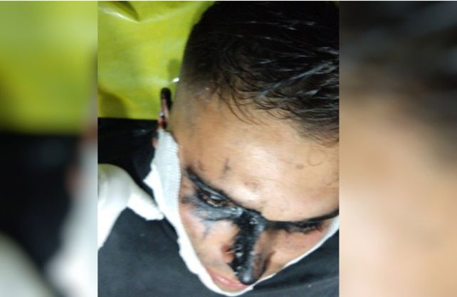 Dos policías del Comando Radioeléctrico fueron quemados con brea caliente
