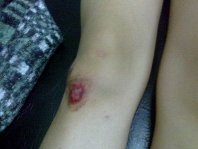 Una menor de edad está grave tras ser atacada por una patota de mujeres