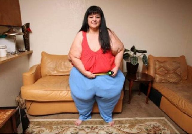 Terminó con su novio para poder bajar 100 kilos y salvar su vida
