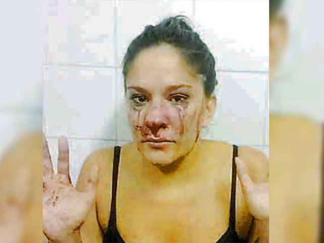 Una patota de mujeres le dio una paliza a una joven por ser cheta