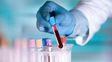 Cuál es la alteración de la sangre que se diagnostica con frecuencia en Rosario