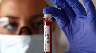 El estudio epidemiológico se hizo para determinar el nivel de anticuerpos