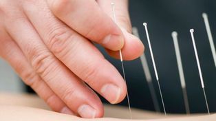 La medicina tradicional china consigue cada vez mayor aceptación
