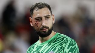 Las secuelas que le quedaron en el rostro a Gianluigi Donnarumma, quien este jueves será sometido a diversos estudios.