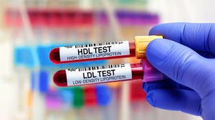 Colesterol alto: por qué se puede tener aún con peso saludable y ejercicio