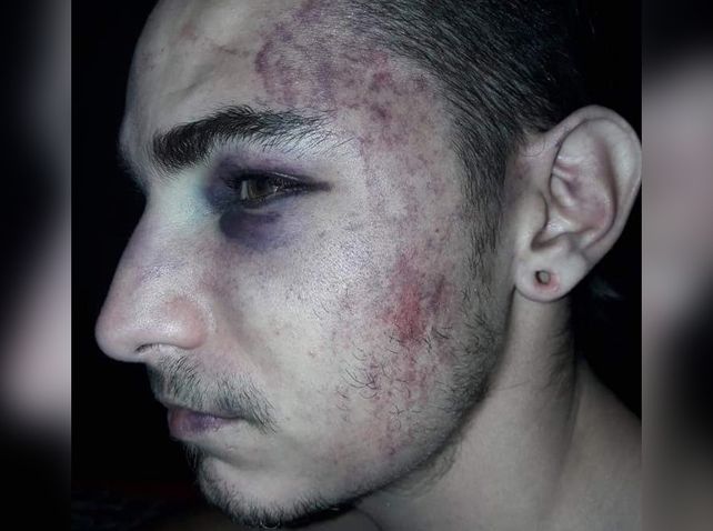 Así quedó uno de los chicos agredidos tras los apremios a los que fue sometido por los policías.&nbsp;