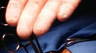 Le sacaron un escarbadientes del corazón que habría tragado comiendo una picada