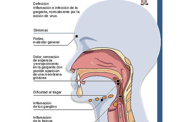¿Cómo es el cuadro de salud que padece la Presidenta?