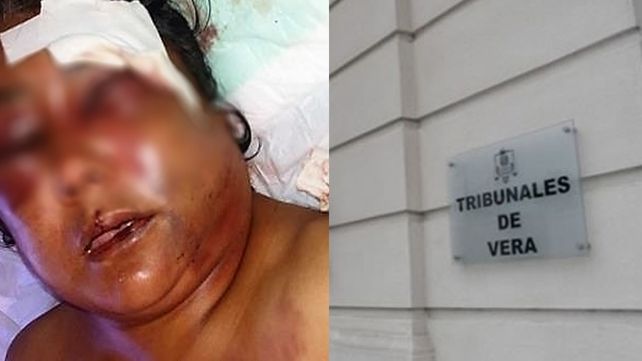 Seis años de prisión para un hombre que robó y golpeó salvajemente a una mujer en Vera