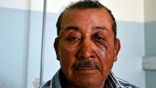 La pasé mal con el puma y ahora hay que sanar las heridas