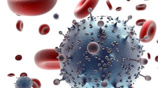 Las infecciones de sida bajaron 35 por ciento en el mundo desde el año 2000