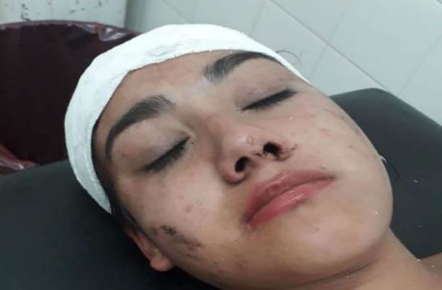 Una joven sufrió una paliza en manada en un boliche en el sur de Santa Fe y está grave