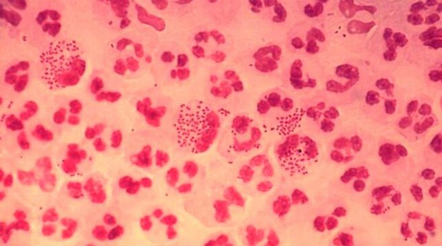 Otro problema. Imagen microscópica de la bacteria causante de la gonorrea.