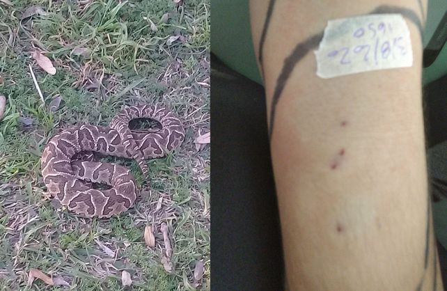 La serpiente y las marcas en el brazo de la joven