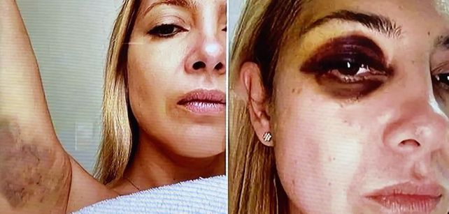 Difundieron fotos de la denuncia de Fabiola Yañez contra Alberto Fernández