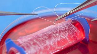 Ya se implantan vaginas, tráqueas y fosas nasales fabricadas en laboratorios científicos