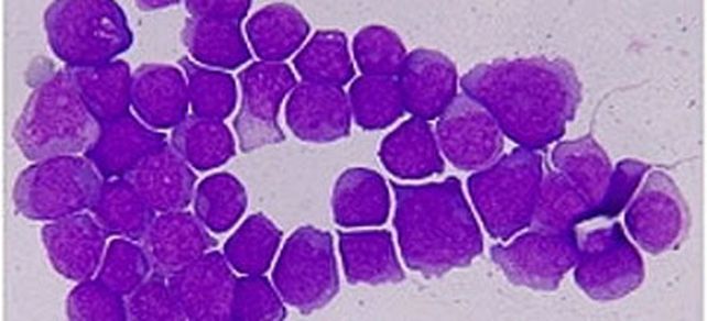 Sospechan que el c&aacute;ncer presenta mutaciones &uacute;nicas en cada enfermo