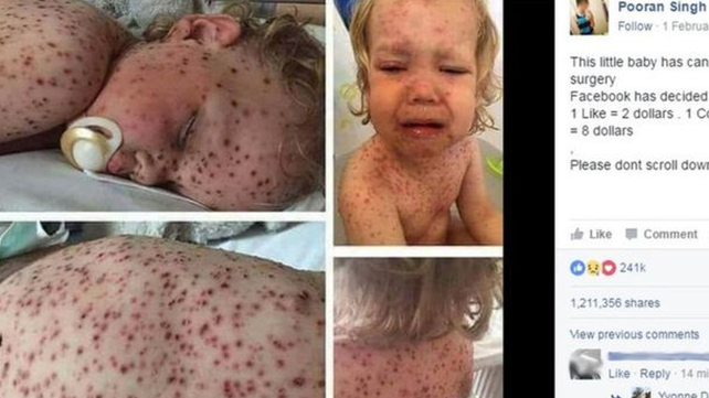 Las páginas de Facebook que usan fotos de niños enfermos para estafar