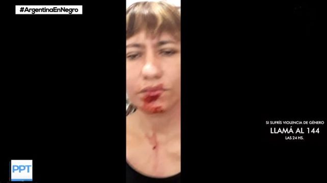 Escándalo en Formosa: un concejal golpeó a una mujer y el intendente la echó por hacer la denuncia