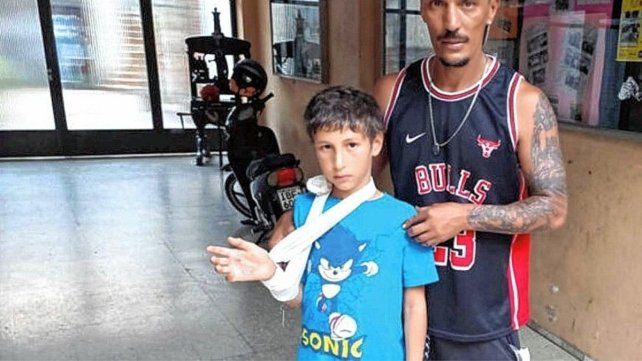 Extraño incidente en Paysandú: un niño mordido por un pez dorado en el Balneario Municipal.