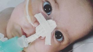 El dramático pedido de los padres de Aquiles, el bebé con atrofia muscular espinal