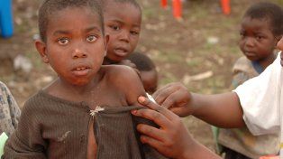 Unos 40 millones de niños no fueron vacunados contra el sarampión