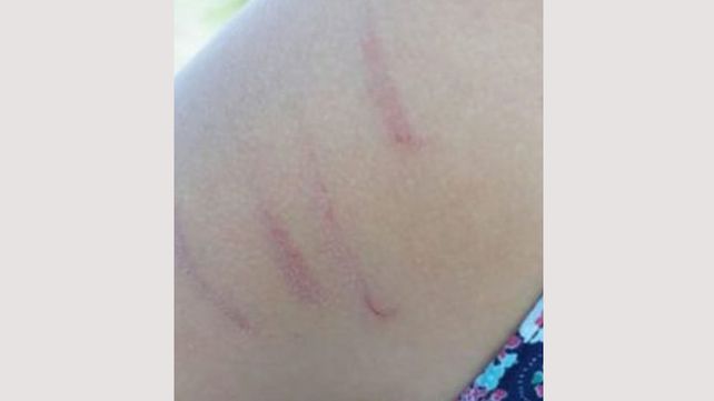 Joven denunció a su novio policía, por violento