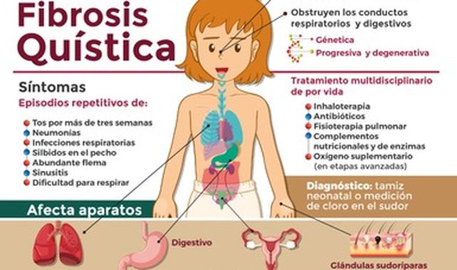Día Mundial: se calcula que hay 3.000 enfermos de fibrosis quística en el país
