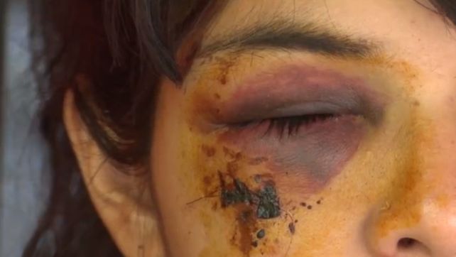 Una mujer se quejó porque estaban tirando tiros al aire y casi le sacan un ojo de un piedrazo