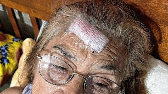 La mujer de 71 años La mujer de 71 años