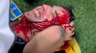 Un entrerriano fue herido durante la represión en el partido entre Argentina y Brasil.