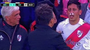 Aliendro y su rostro.